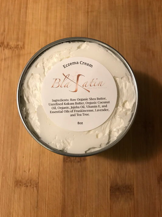 Eczema Cream